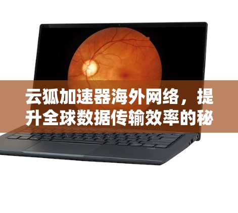 云狐加速器海外网络,提升全球数据传输效率的秘密武器